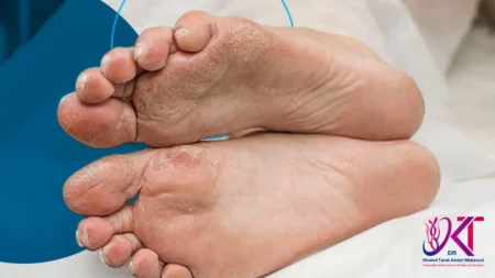 افضل دكتور لعلاج القدم السكري