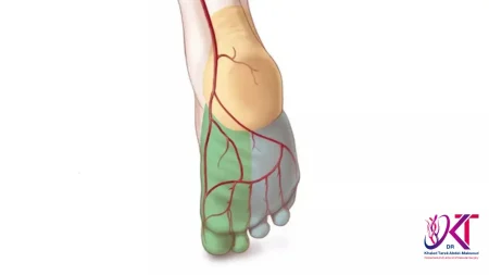 علاج انسداد الشرايين الطرفية